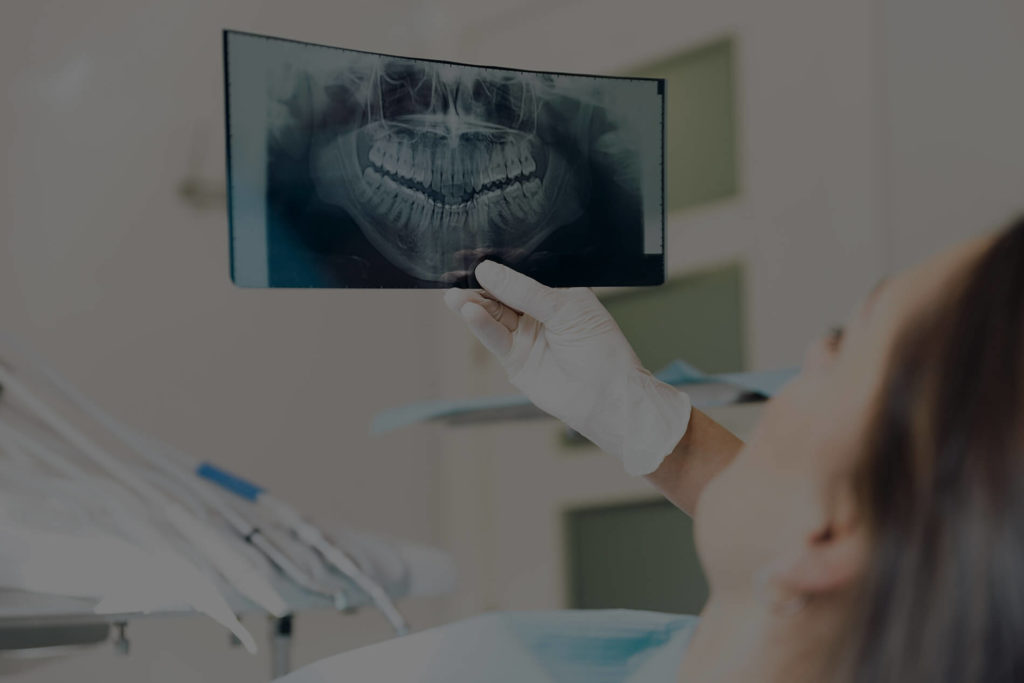 Equipos radiologicos